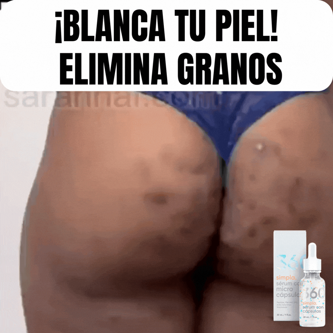 GIF-1-2.gif