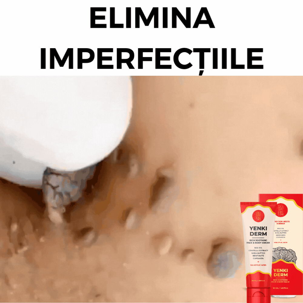 ELIMINA IMPERFECȚIILE