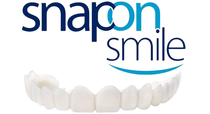 snap-on-smile-prod-1.png